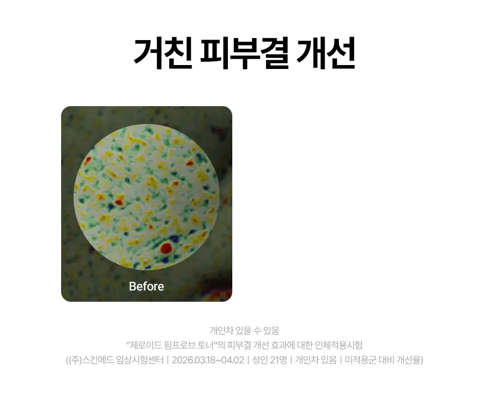 [저자극 각질 케어] 제로이드 핌프로브 토너 200ml 상세페이지 19